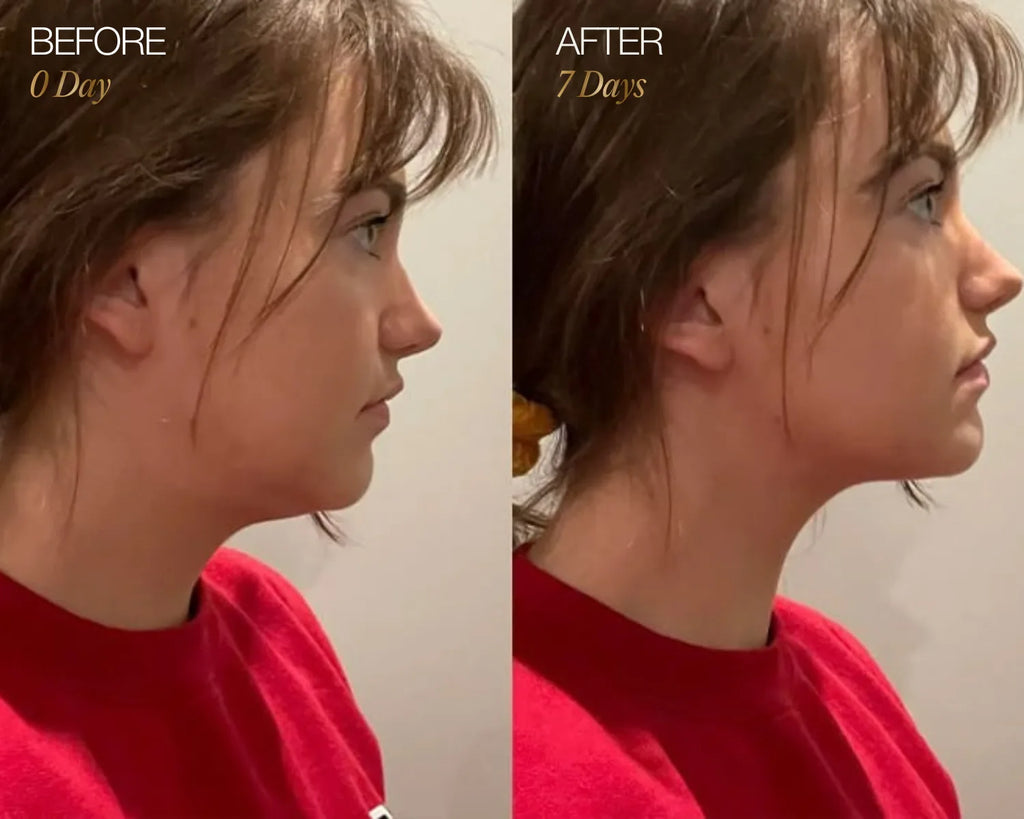 LumiSculpt™ Facial Brush | 1+1 FREE