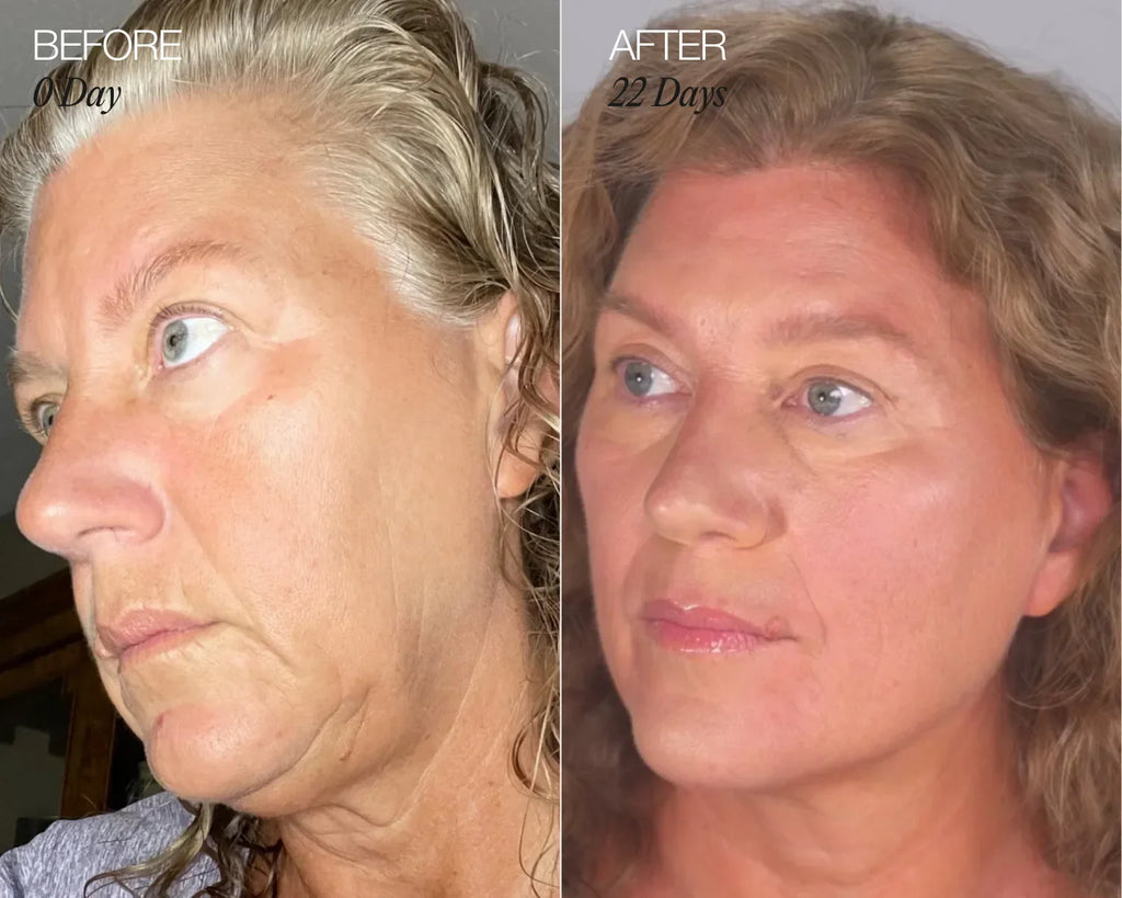 LumiSculpt™ Facial Brush | 1+1 FREE