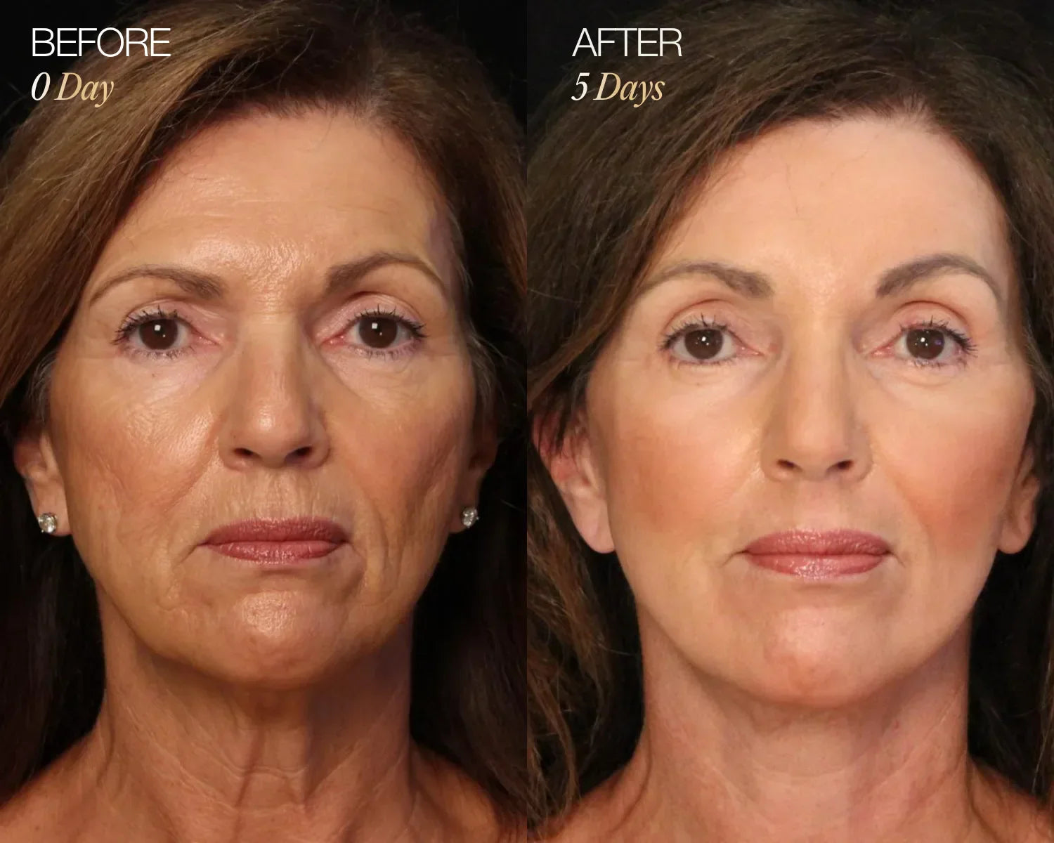 LumiSculpt™ Facial Brush | 1+1 FREE