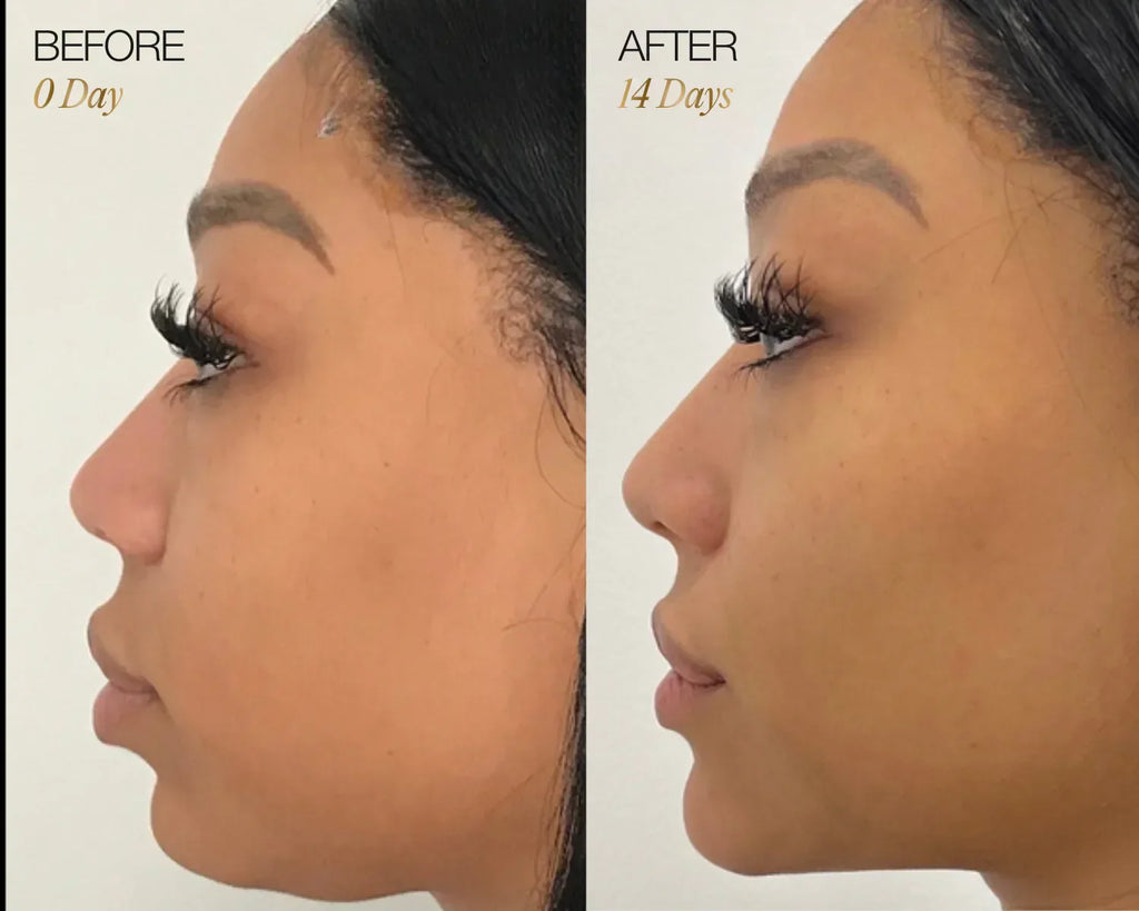 LumiSculpt™ Facial Brush | 1+1 FREE